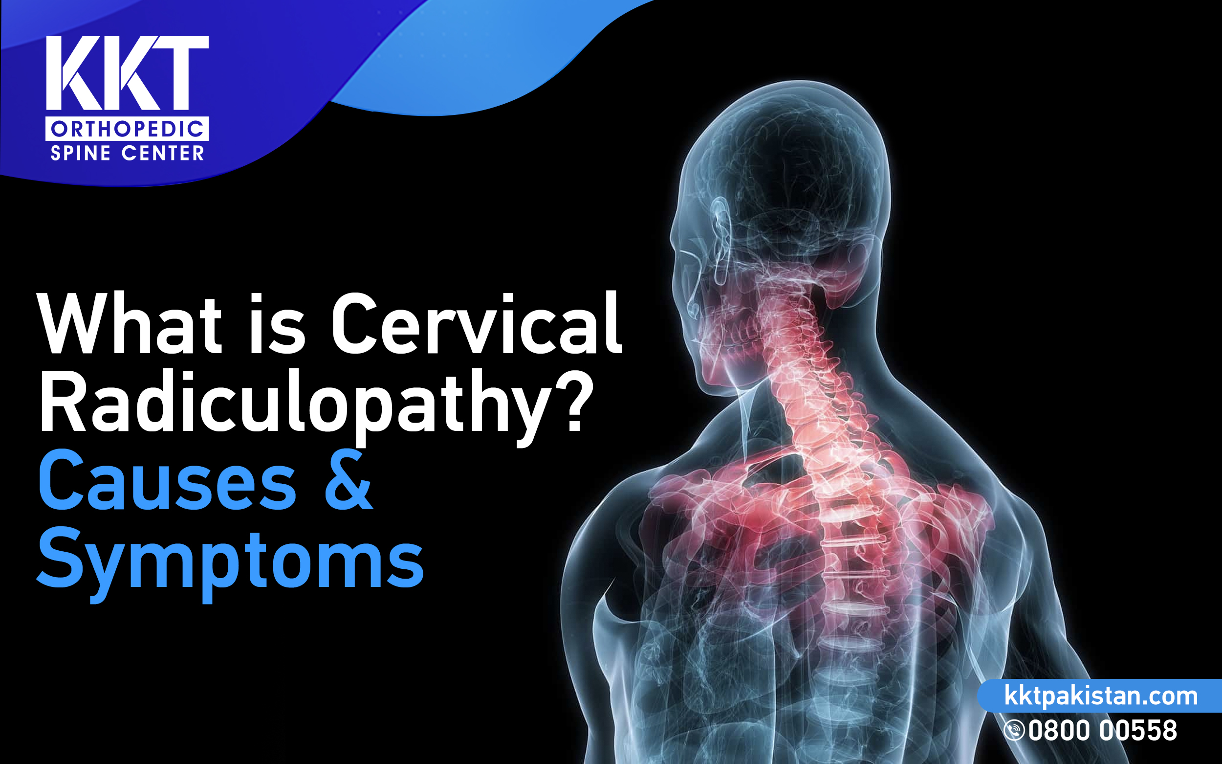 Cervical Radiculopathy Symptoms Causes And Treatments Eduaspirant