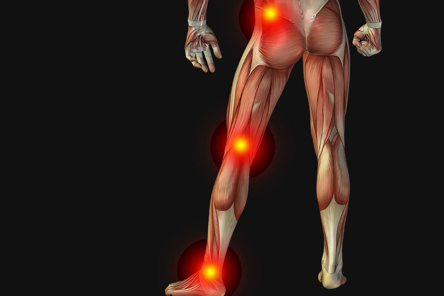 sciatica symptoms constant pain