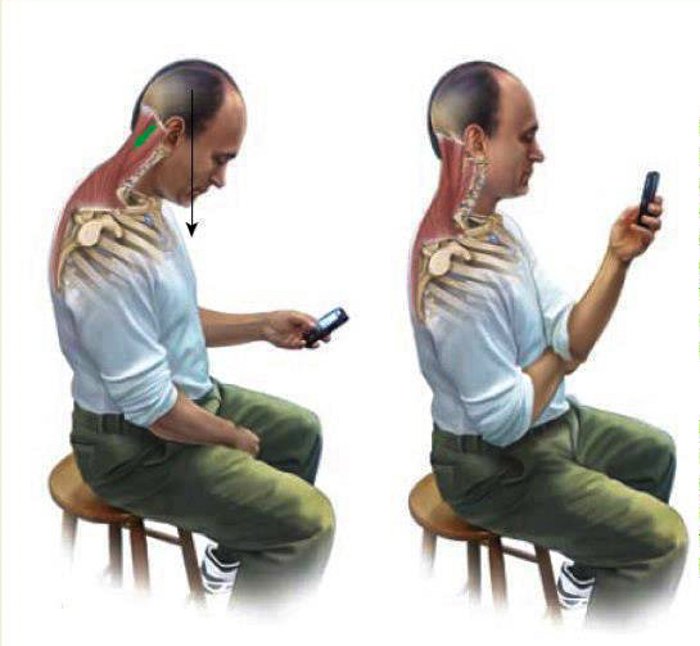 Prevent Neck Pain Text Neck