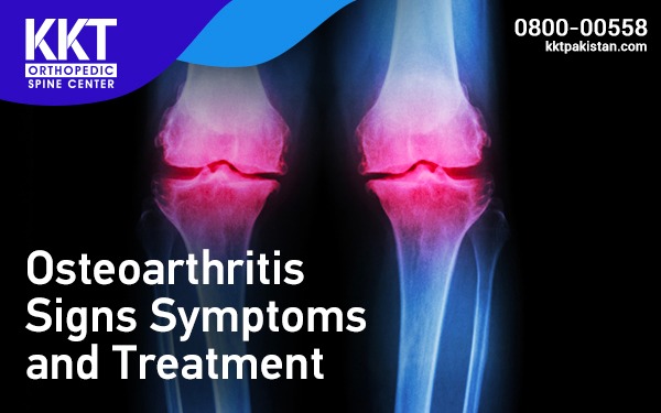 Osteoarthritis Signs Symptoms and Treatment