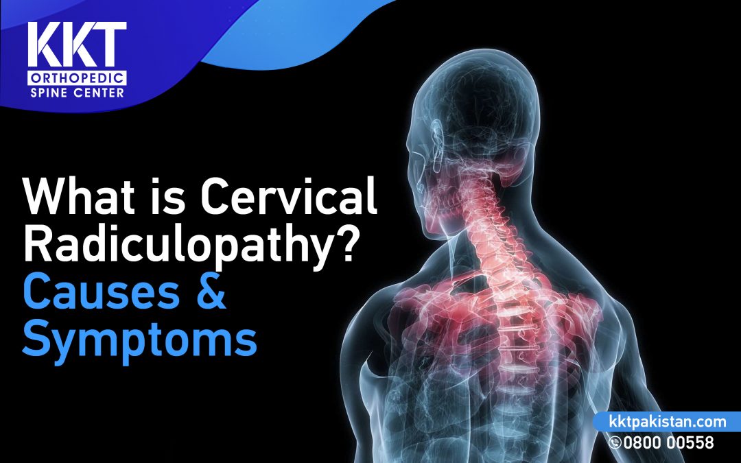 What is Cervical Radiculopathy? Causes and Symptoms