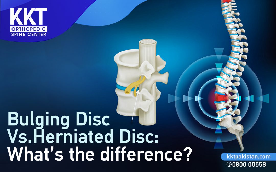 Bulging Disc Vs. Herniated Disc: What’s the difference?