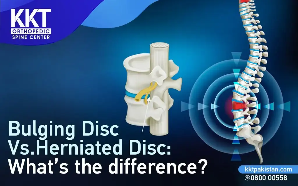 bulging vs hernaited disc