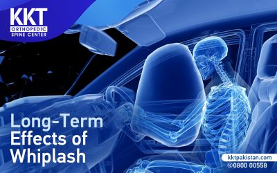 Long-term effects of Whiplash
