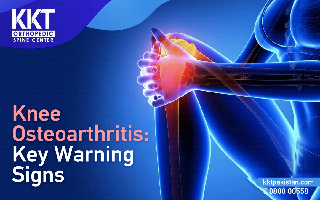 Knee Osteoarthritis: Key Warning Signs