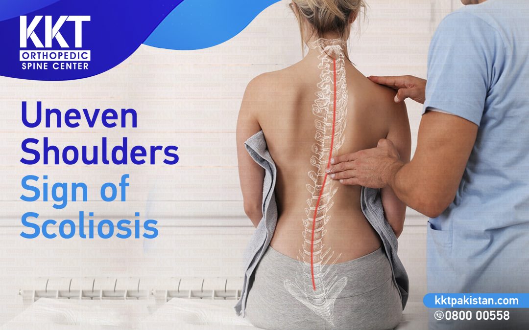 Uneven shoulders scoliosis