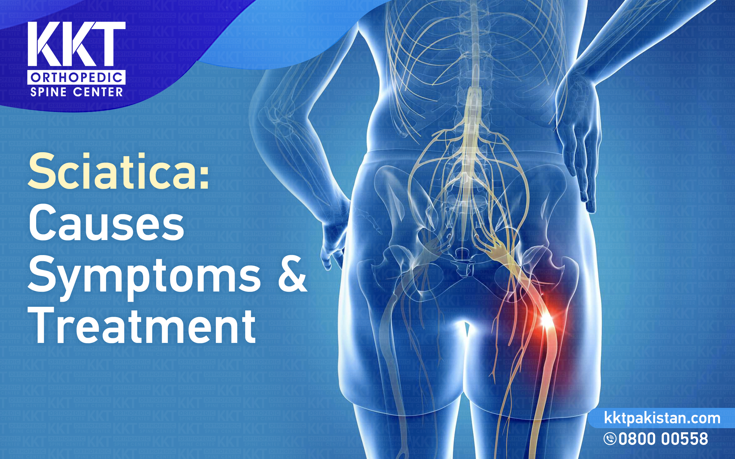 Sciatica Causes, Symptoms, and Treatment