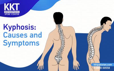 Kyphosis Treatment: Causes and Symptoms