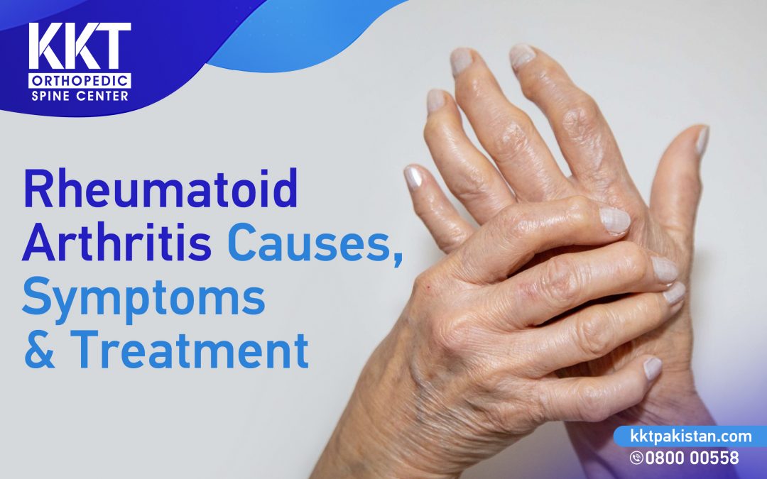 Rheumatoid Arthritis Causes, Symptoms & Treatment