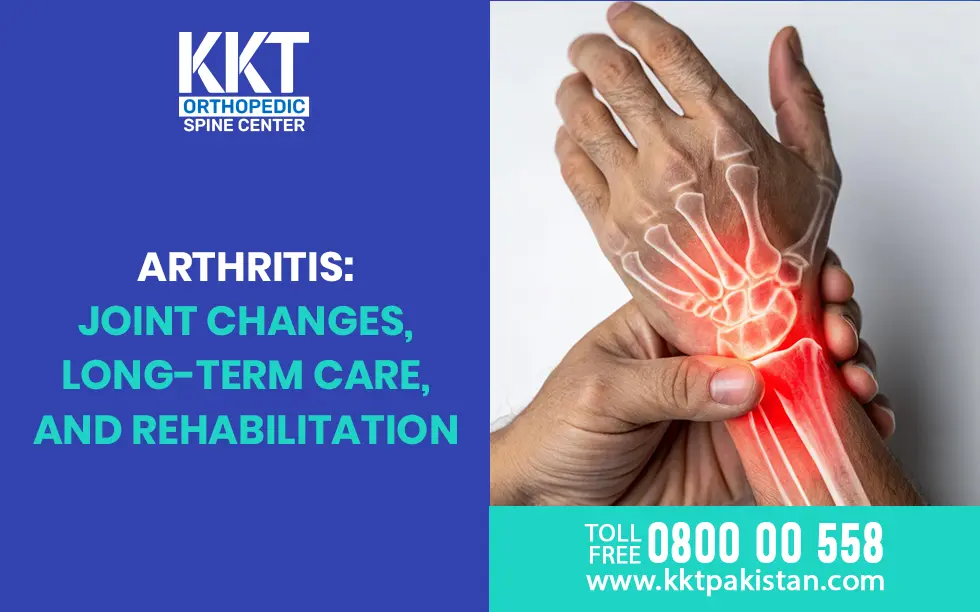Arthritis